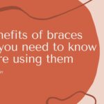 Don’t Just Use Braces, You Must Know the 5 Benefits of Braces Below