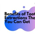 Benefits of Tooth Extractions That You Can Get
