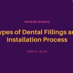 Types of Dental Fillings and Installation Process
