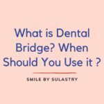 What is Dental Bridge? When Should You Use it ?