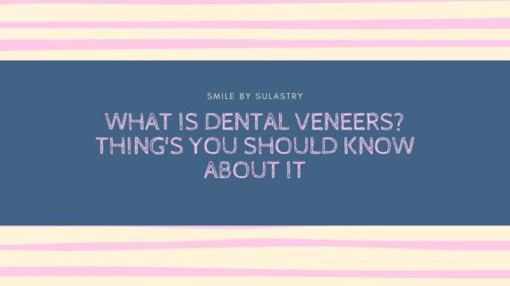 What is Dental Veneers? Thing’s You Should Know About It