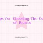 Tips for Choosing The Color of Braces