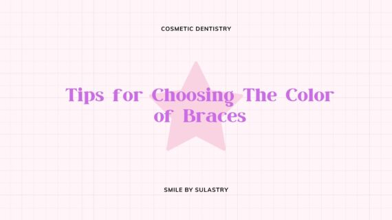 Tips for Choosing The Color of Braces