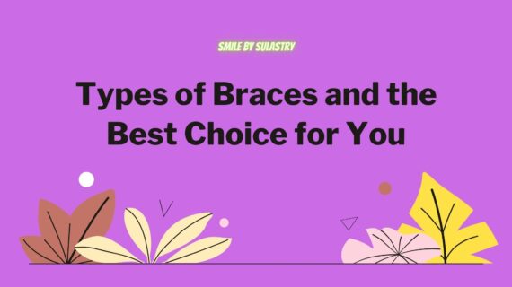 Types of Braces and the Best Choice for You